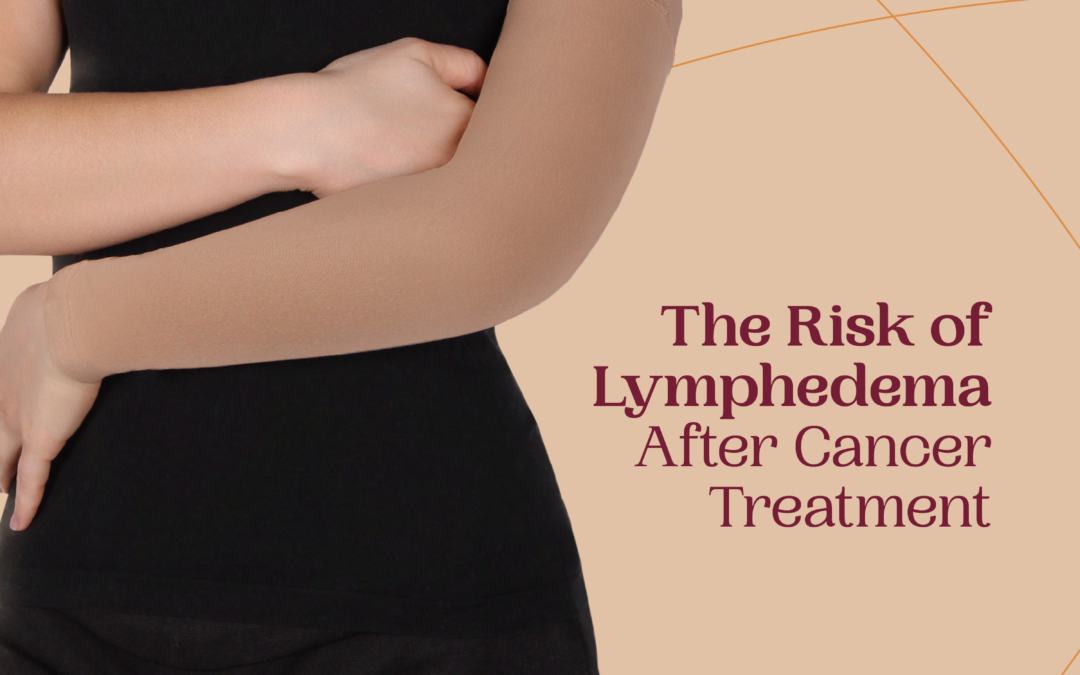 The Risk of Lymphedema After Cancer Treatment–How to Heal