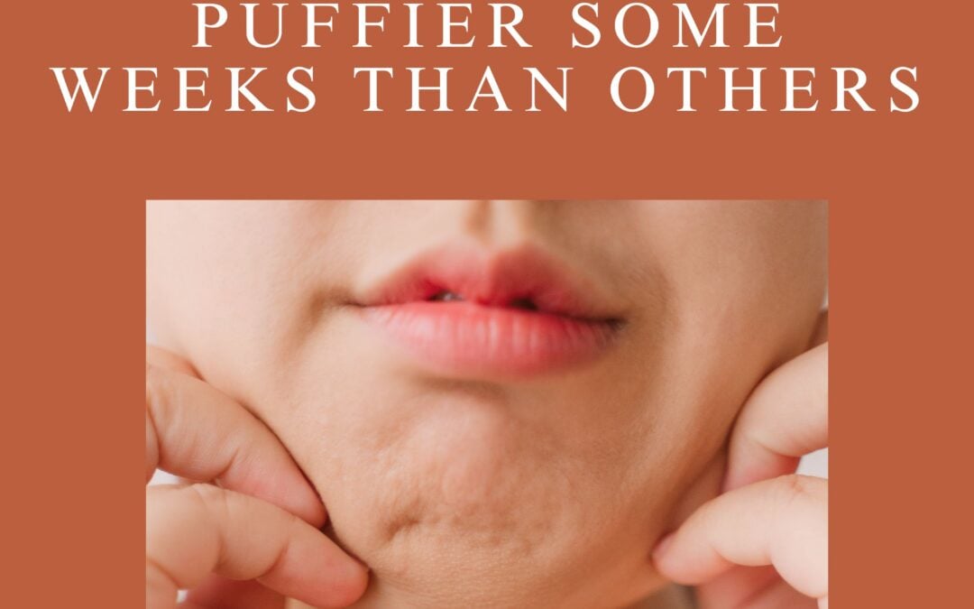 Why You Feel Puffier Some Weeks Than Others: Hormones and Fluid Retention